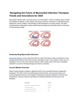 MI Therapeutics Market Insights: Treatments and Innovations