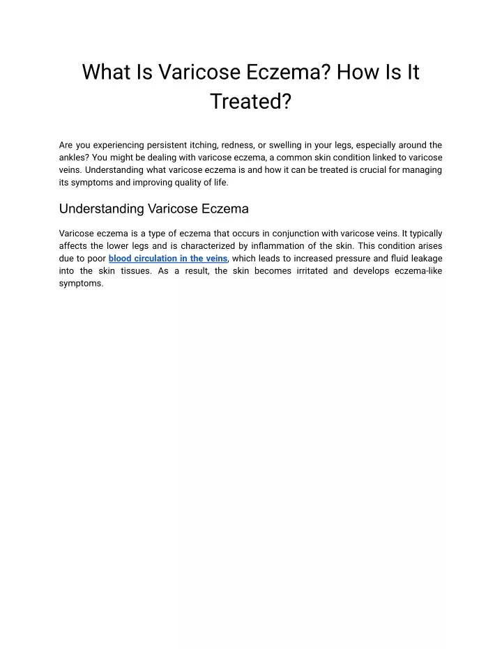 what is varicose eczema how is it treated