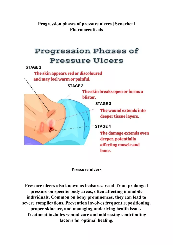 progression phases of pressure ulcers synerheal