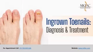 Ingrown Toenail Surgeries Doctors in Mumbai | MKFAC