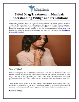 Effective Safed Daag Treatment in Mumbai
