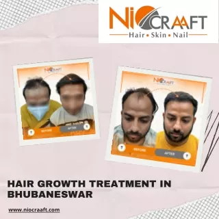 Hair Growth Treatment in Bhubaneswar - Niocraaft