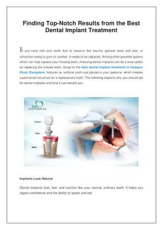 Finding Top-Notch Results from the Best Dental Implant Treatment