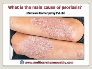 what is the main cause of psoriasis