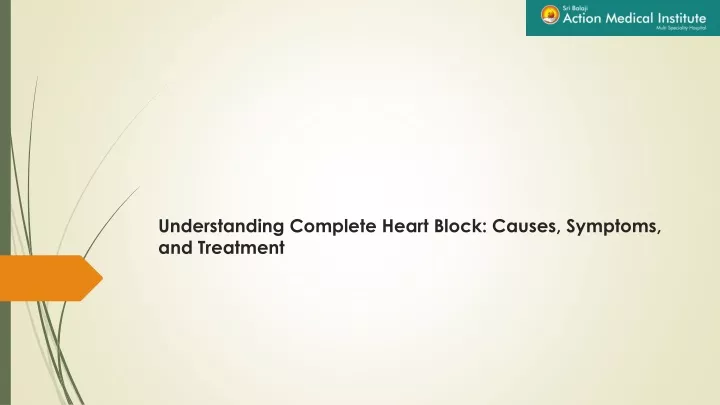 understanding complete heart block causes symptoms and treatment