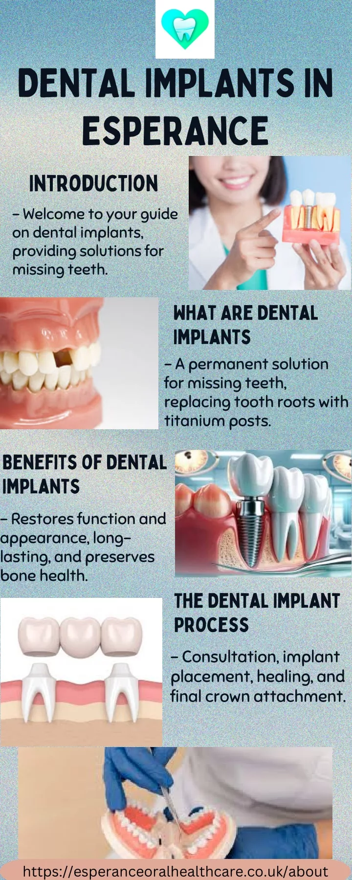 dental implants in esperance