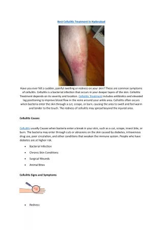 Cellulitis Treatment in Hyderabad