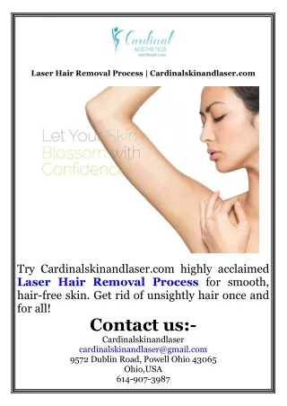 Laser Hair Removal Process  Cardinalskinandlaser.com