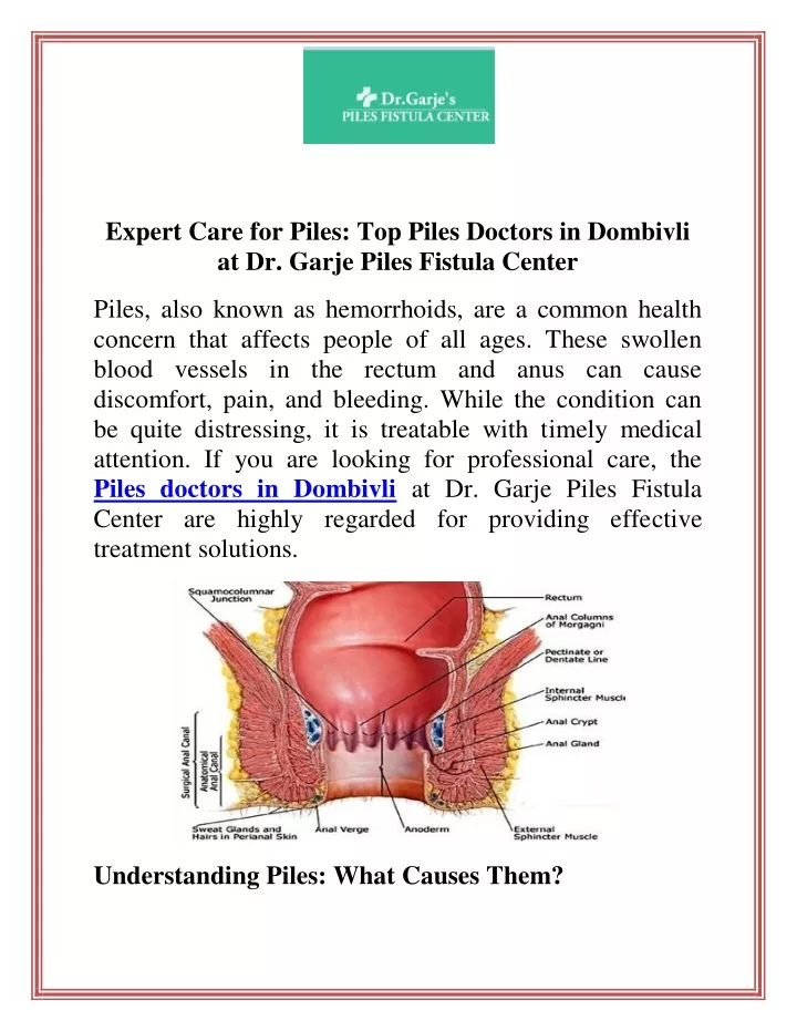 expert care for piles top piles doctors