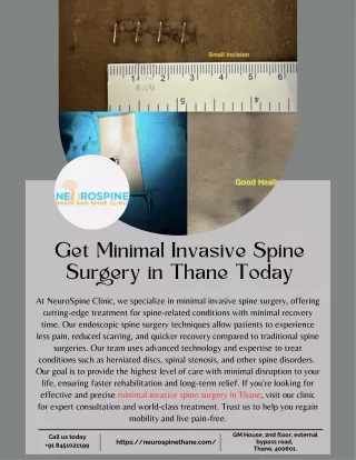 Get Minimal Invasive Spine Surgery in Thane Today