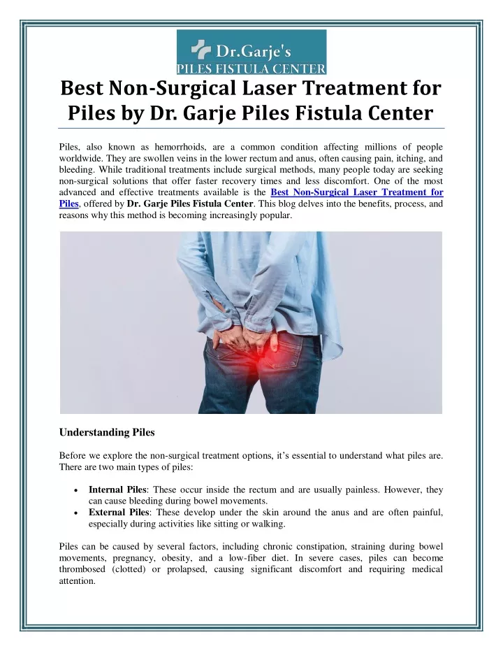 best non surgical laser treatment for piles