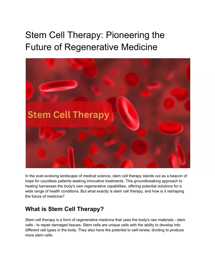 stem cell therapy pioneering the future