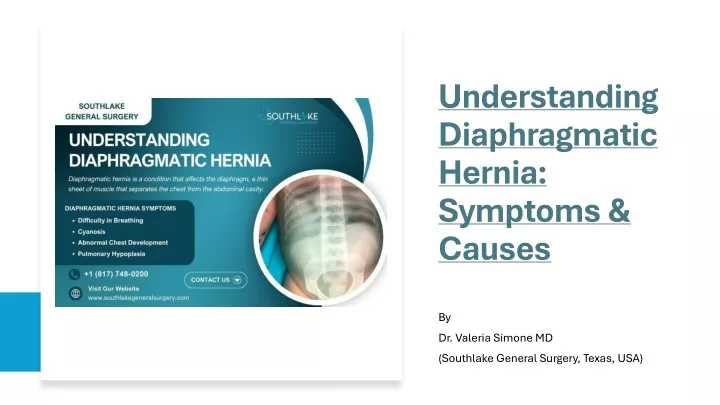 understanding diaphragmatic hernia symptoms causes