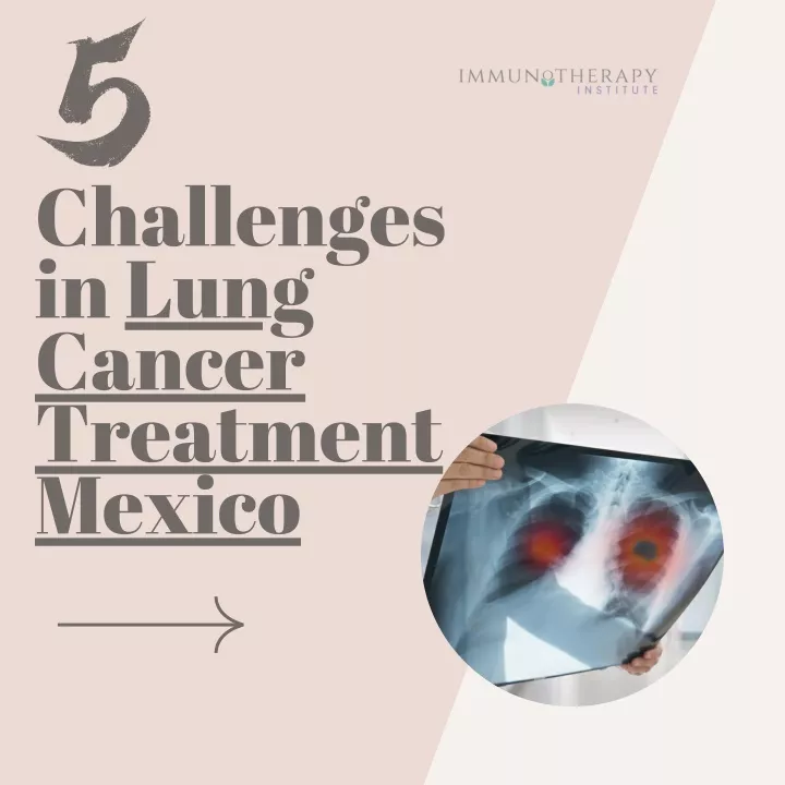 challenges in lung cancer treatment mexico