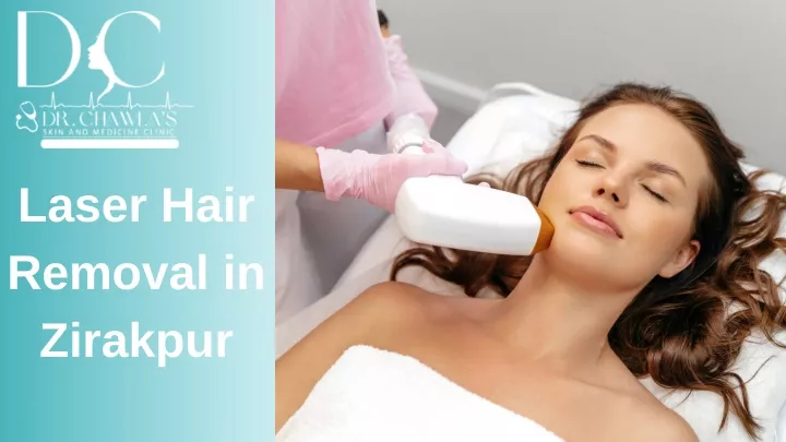 laser hair removal in zirakpur