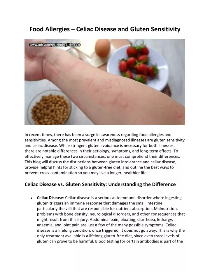 food allergies celiac disease and gluten