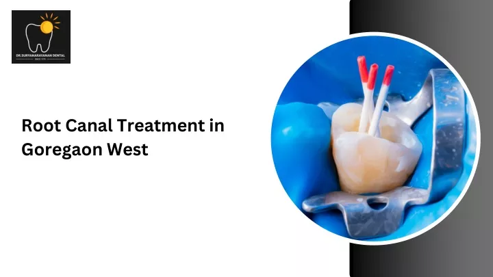 root canal treatment in goregaon west