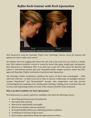 Refine Neck Contour with Neck Liposuction