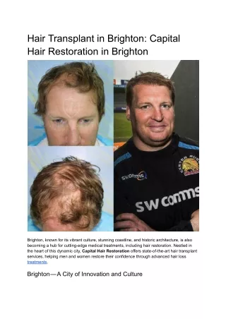 Brighton Hair Transplant