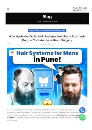 How-Made-to-Order Hair Systems Help Pune Residents Regain Confidence Without-Surgery