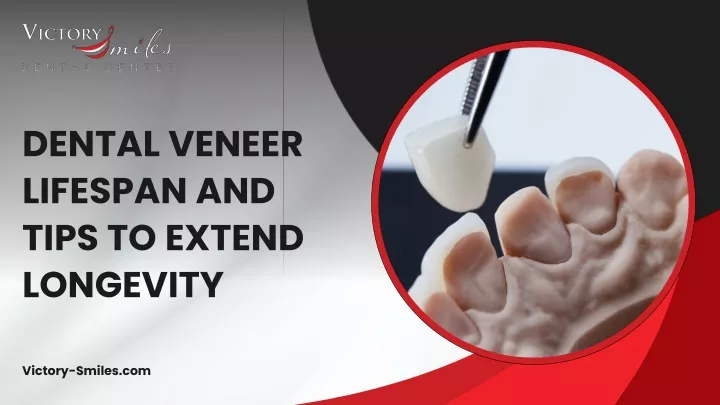 dental veneer lifespan and tips to extend