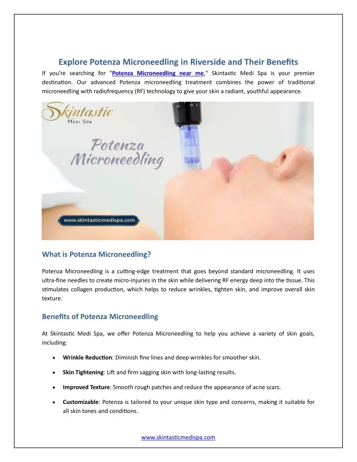 explore potenza microneedling in riverside