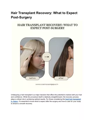 Hair Transplant Recovery_ What to Expect Post-Surgery
