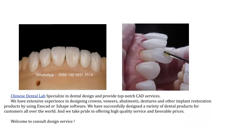 chinese dental lab specialize in dental design