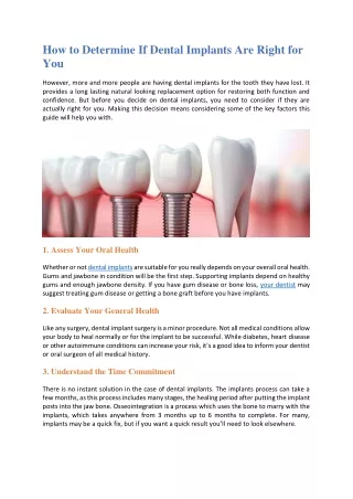 How to Determine If Dental Implants Are Right for You