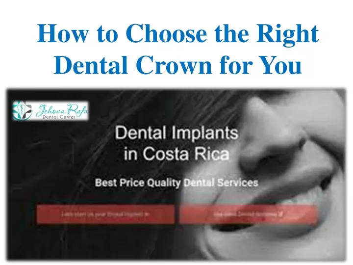 how to choose the right dental crown for you