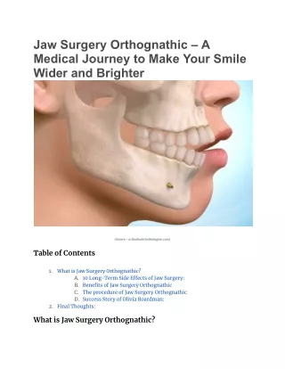 Jaw Surgery Orthognathic – A Medical Journey to Make Your Smile Wider and Brighter