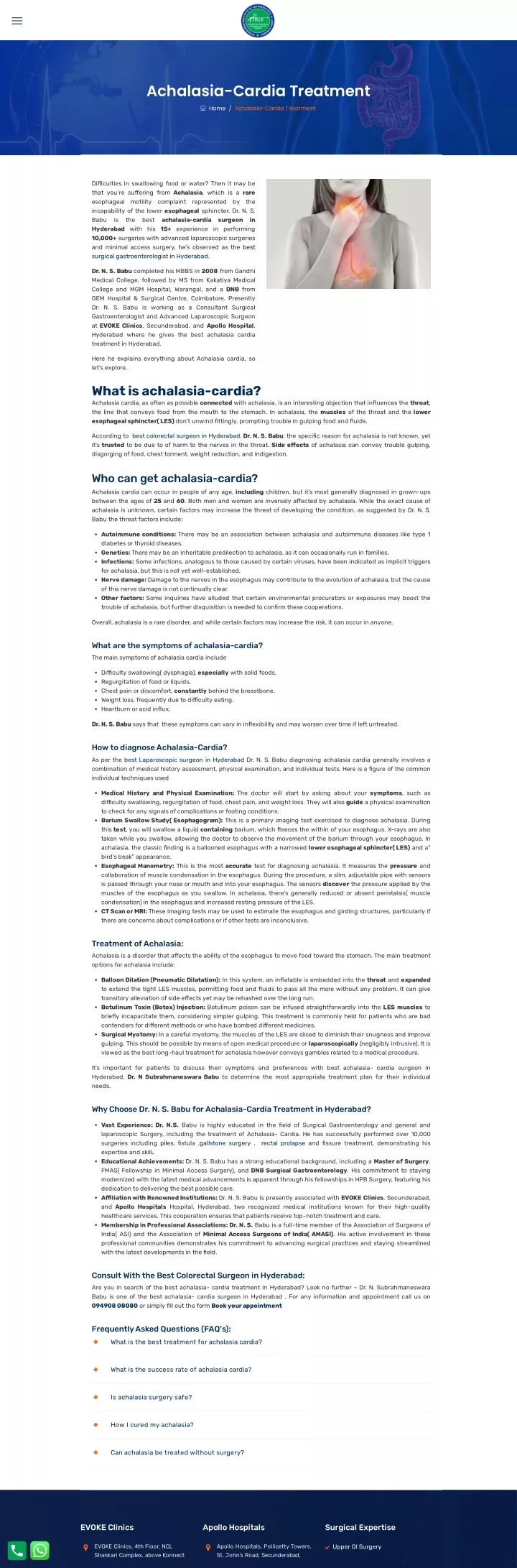 achalasia cardia treatment