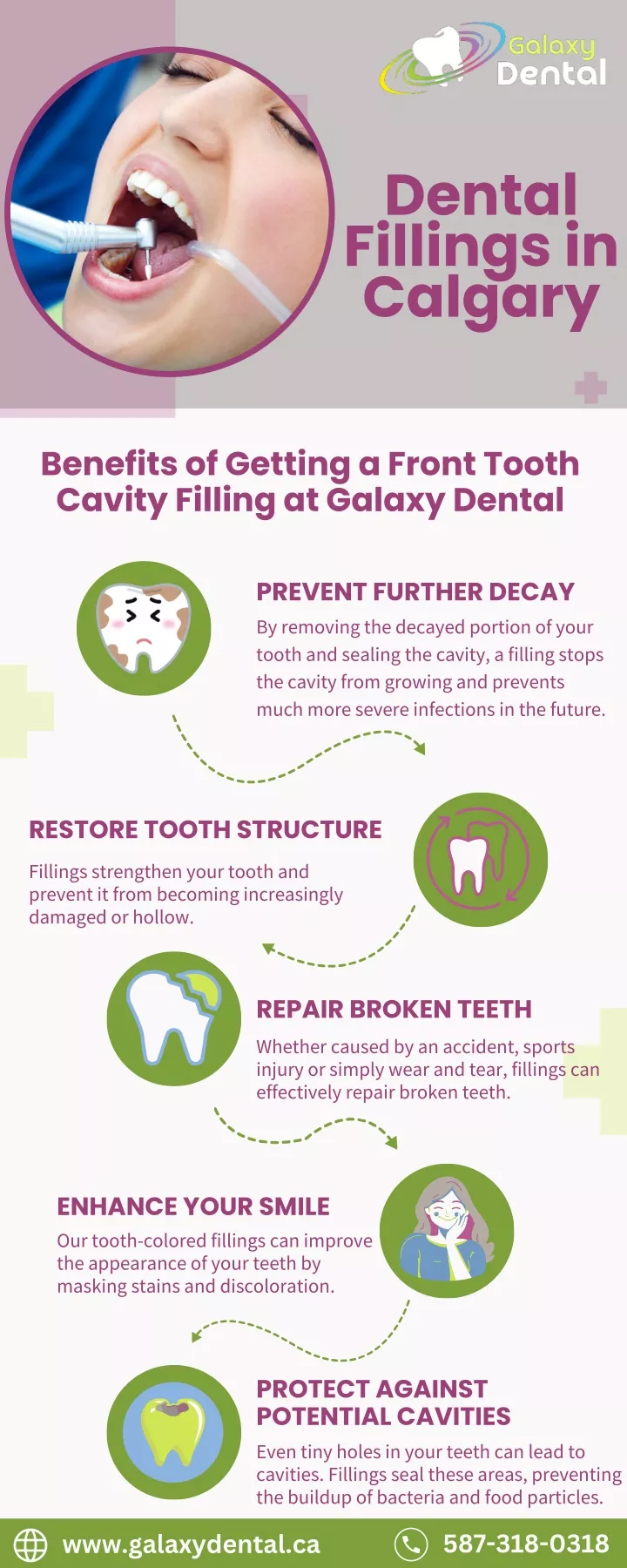 dental fillings in calgary