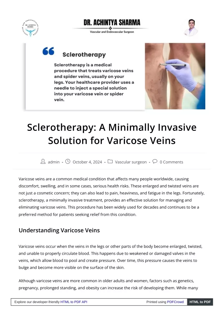 sclerotherapy a minimally invasive solution