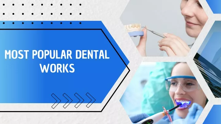 most popular dental works