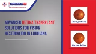 Advanced Retina Transplant Solutions for Vision Restoration in Ludhiana