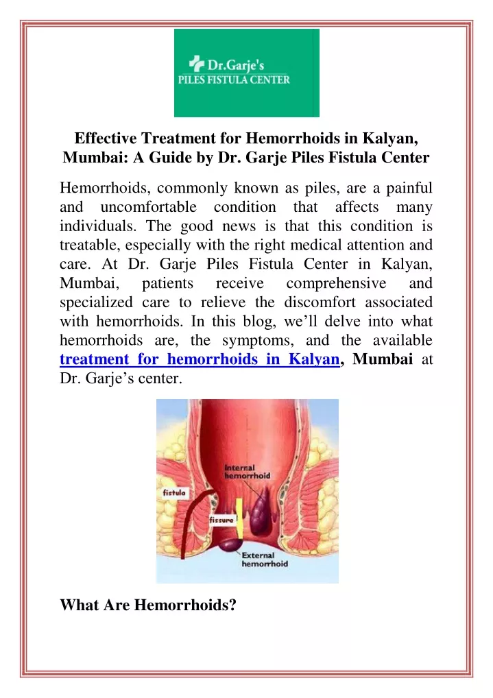 effective treatment for hemorrhoids in kalyan