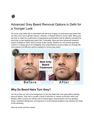 Best Grey Beard Treatment