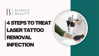 4 STEPS TO TREAT LASER TATTOO REMOVAL INFECTION