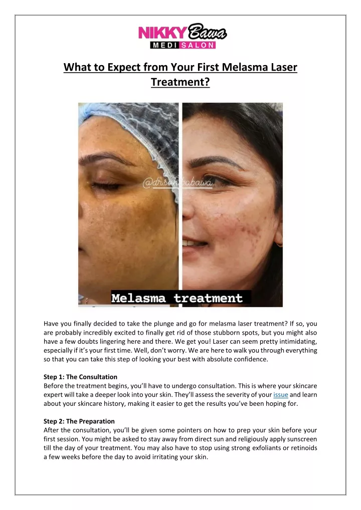 what to expect from your first melasma laser