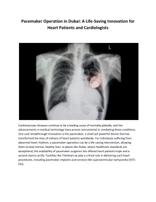 Pacemaker Operation in Dubai