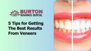 5 Tips for Getting the Best Results from Veneers