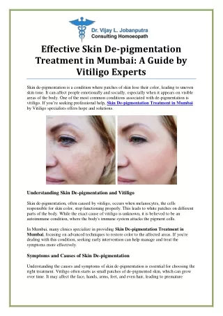 Effective Skin De-pigmentation Treatment in Mumbai for a Radiant Glow