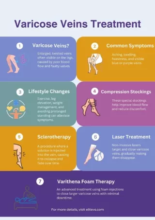 7 Key Points About Varicose Veins Treatment