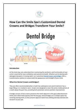How Can the Smile Spa's Customized Dental Crowns and Bridges Transform Your Smile