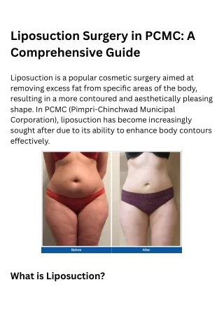liposuction surgery in pcmc a comprehensive guide