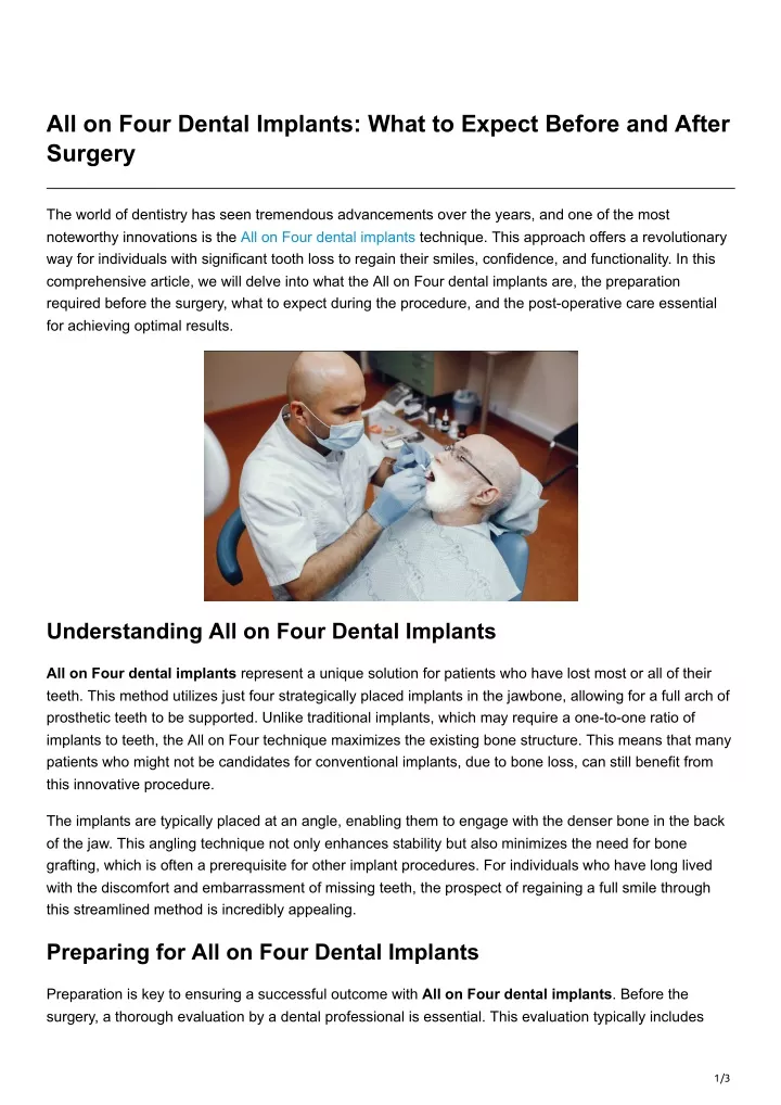 all on four dental implants what to expect before