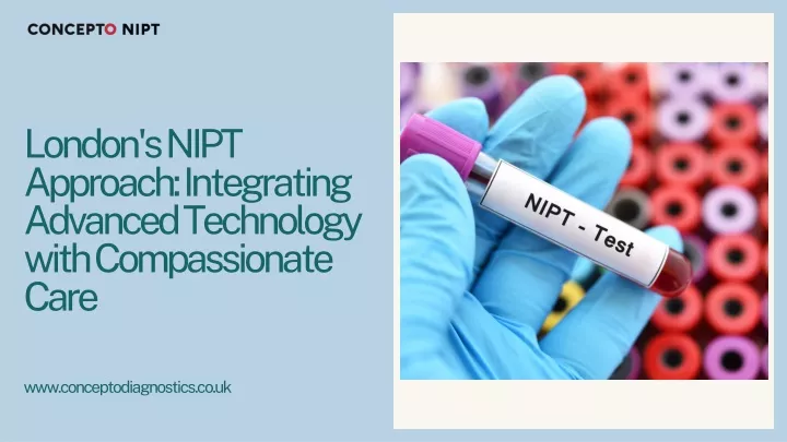 london s nipt approach integrating advanced