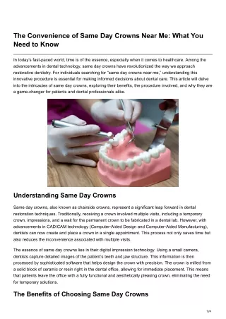 the convenience of same day crowns near me what