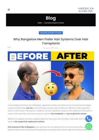 Why-Bangalore Men-Prefer Hair Systems Over Hair-Transplants